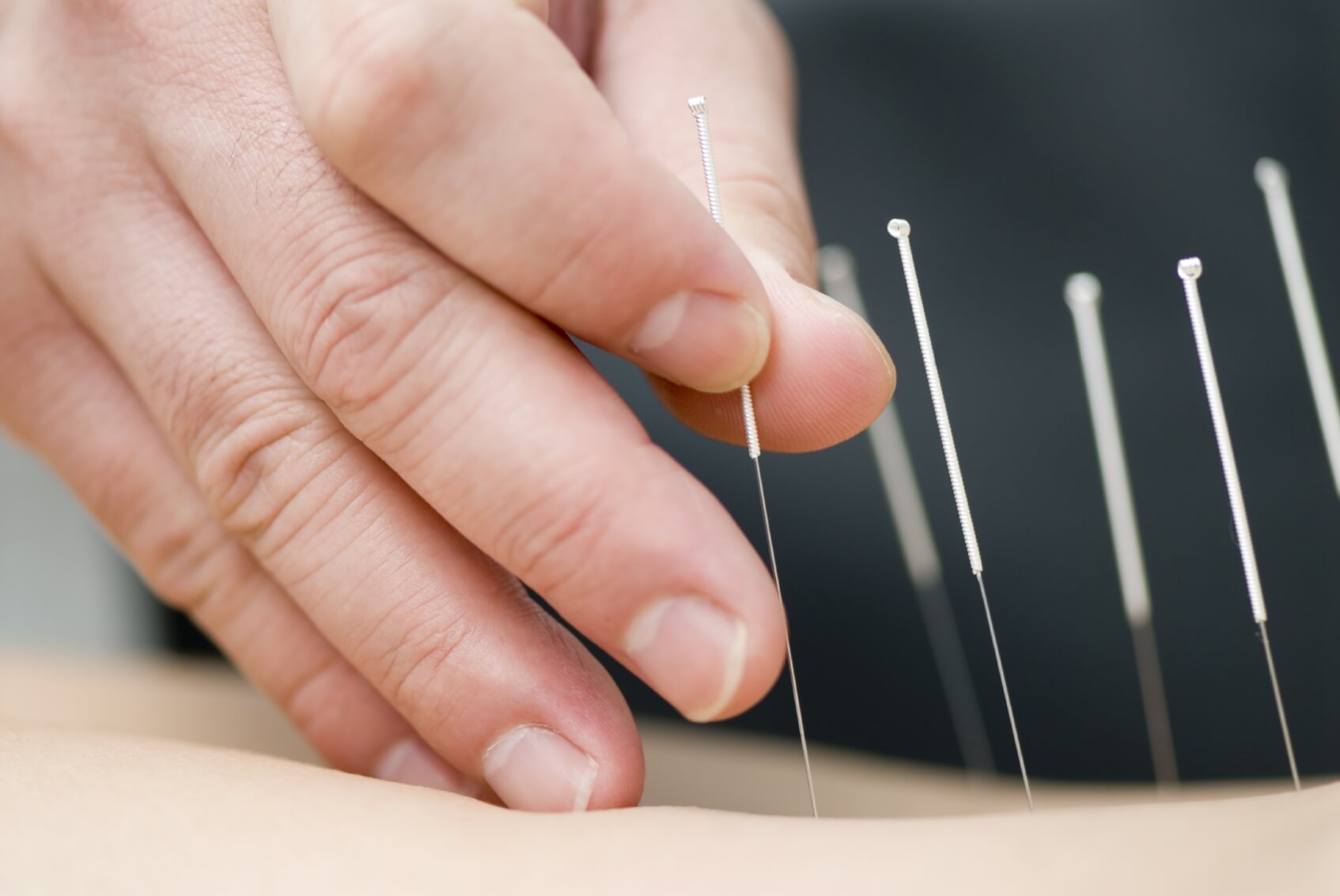 needle therapy for pain