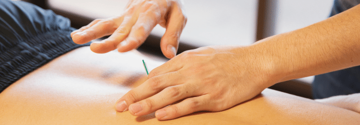 Benefits of Dry Needling for Post-Workout Muscle Recovery